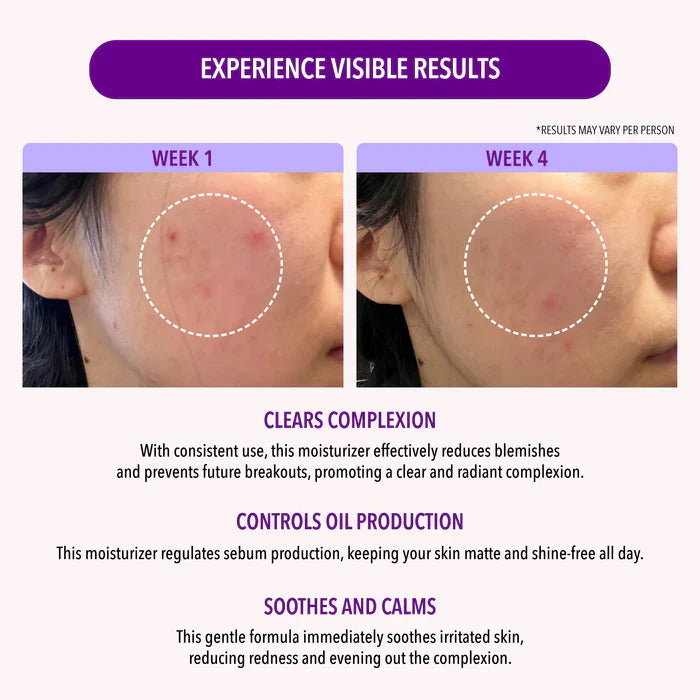 MOIRA Gel Facial Hidratante Con 10% Niacinamida Para Control de Grasa - 50g